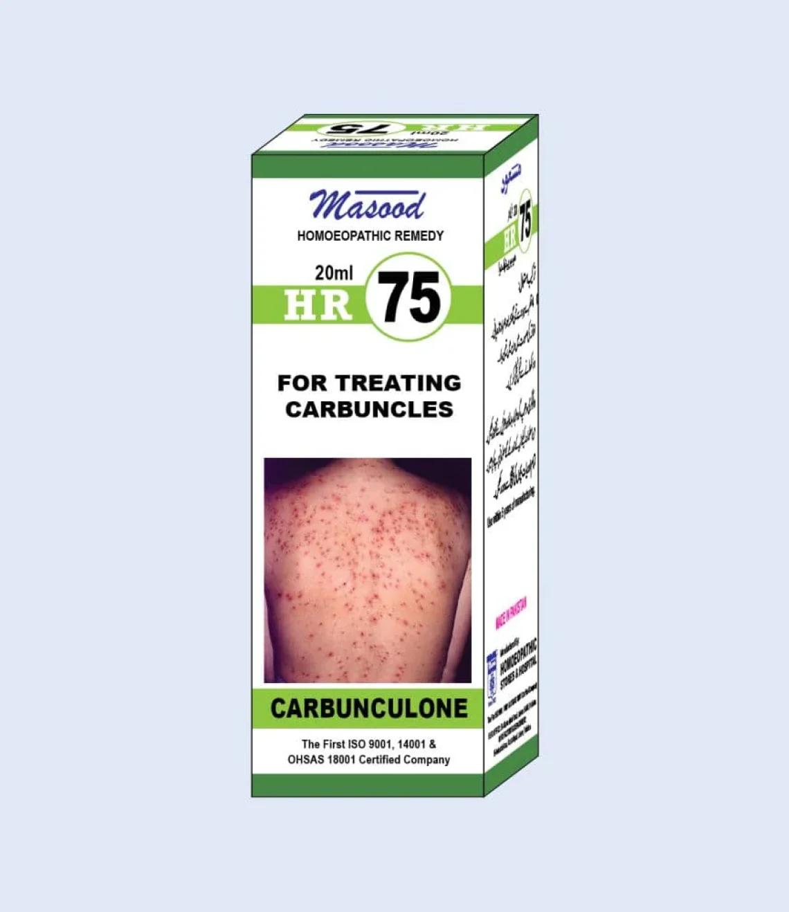 HR-NO-75-CARBUNCULONE